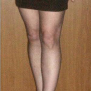 Profielafbeelding MyLegsAreTooLong